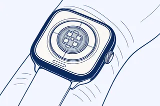 Apple Watch Series 12 and Ultra 4 owners report burning, redness under the sensor