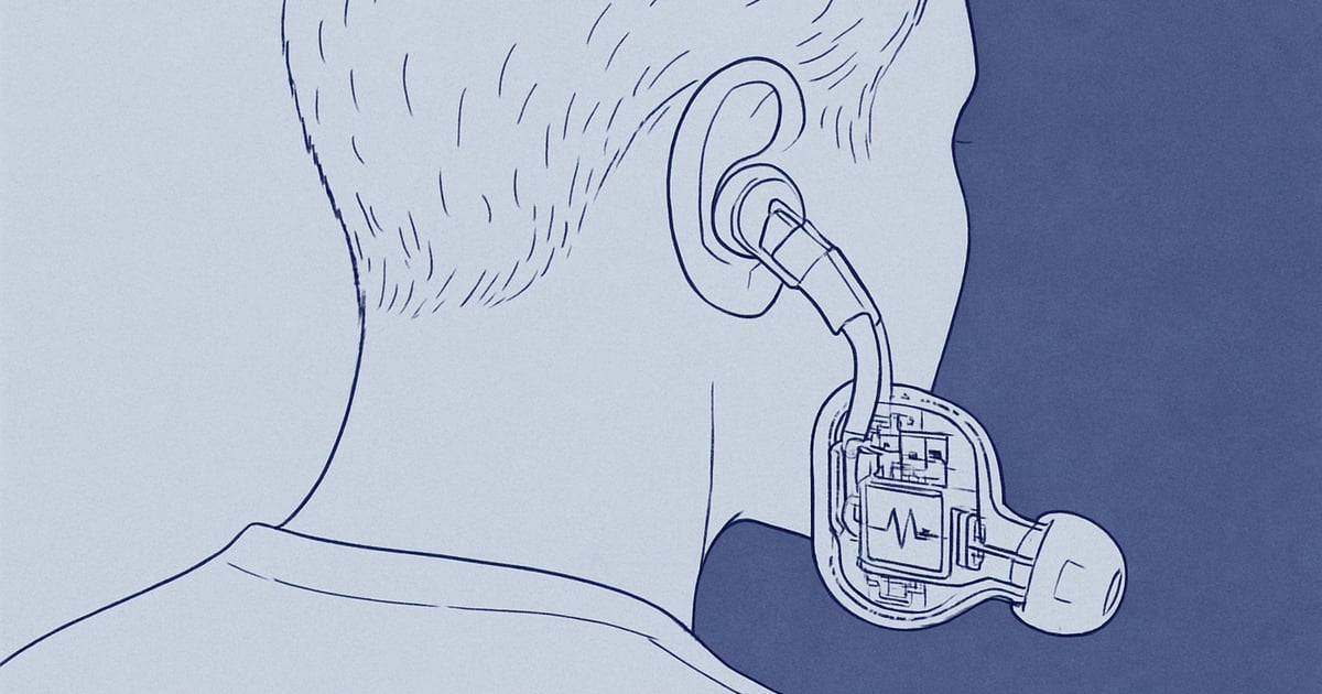 Soundcore put a heart rate sensor inside sleep earbuds